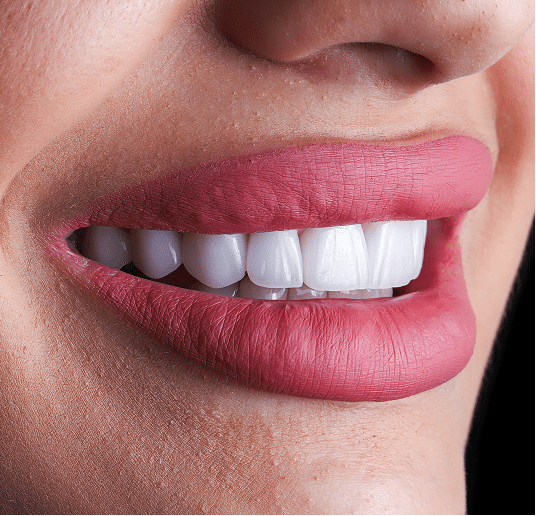 porcelain@1.2x Dentist in Emerson, NJ