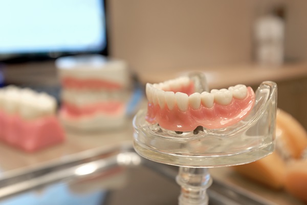 Pros And Cons Of All On   Dental Implants